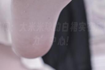 美图时间：大米米球的白裙实在成了‘引力’中心！